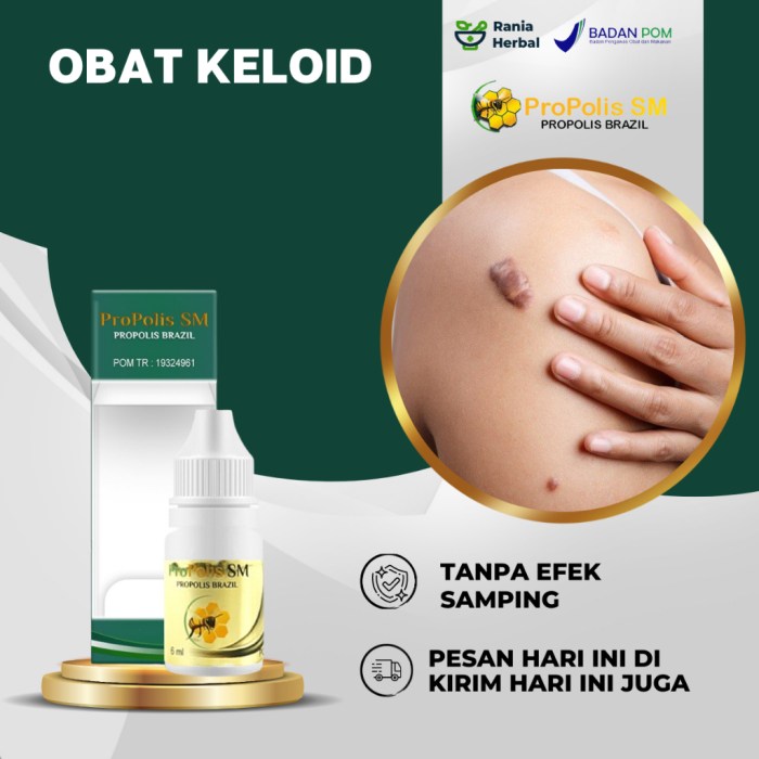 Jangan tunggu bengkak, obati CRD sejak awal
