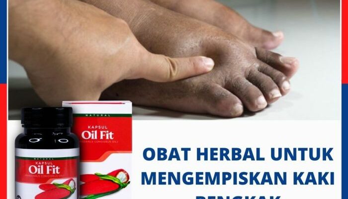 Crd Taktikya Obati Jangan Waktu Bengkak