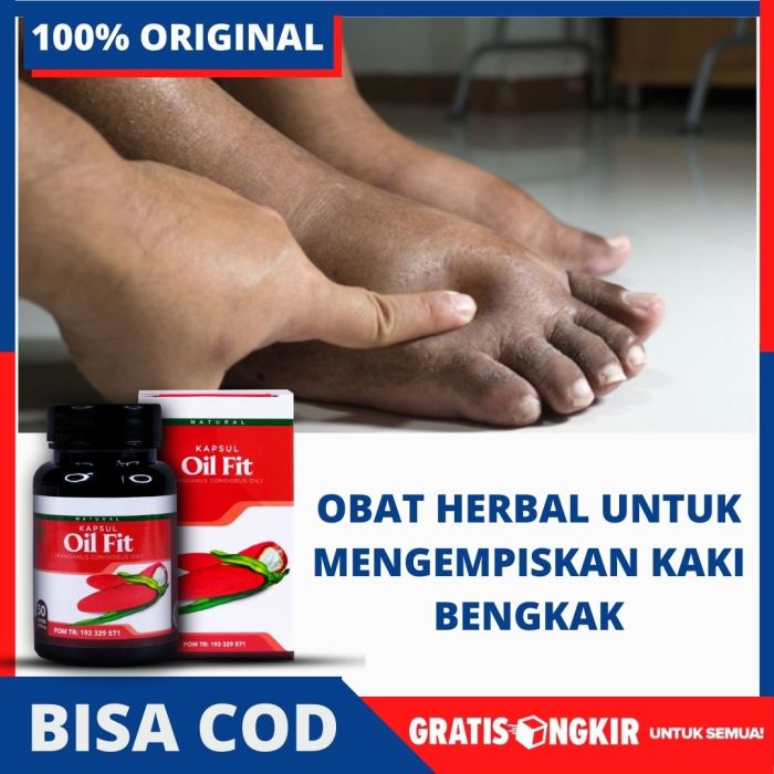 CRD Taktikya Obati jangan Waktu Bengkak